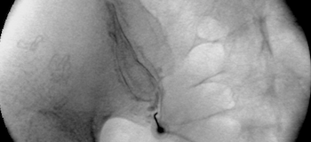 Other Procedures